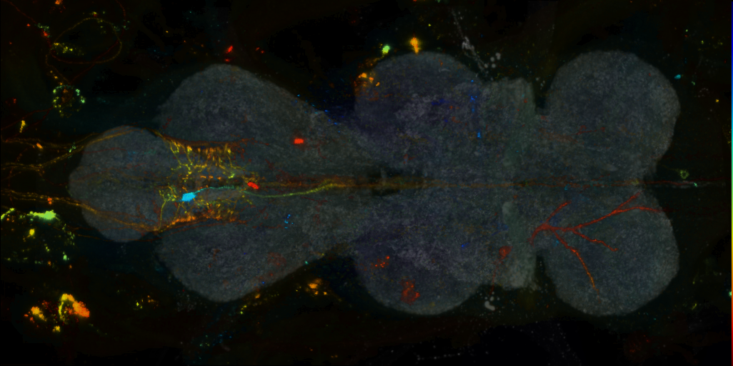 P{VT048493-GAL4} expression pattern