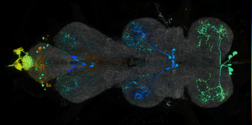 P{VT048874-GAL4} expression pattern
