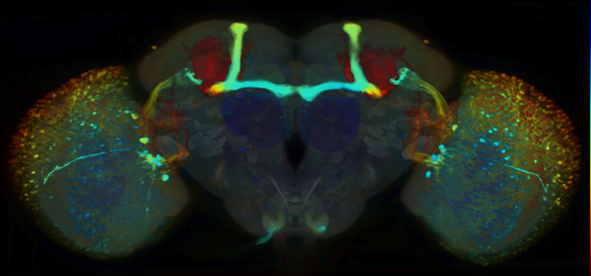P{VT054844-GAL4} expression pattern
