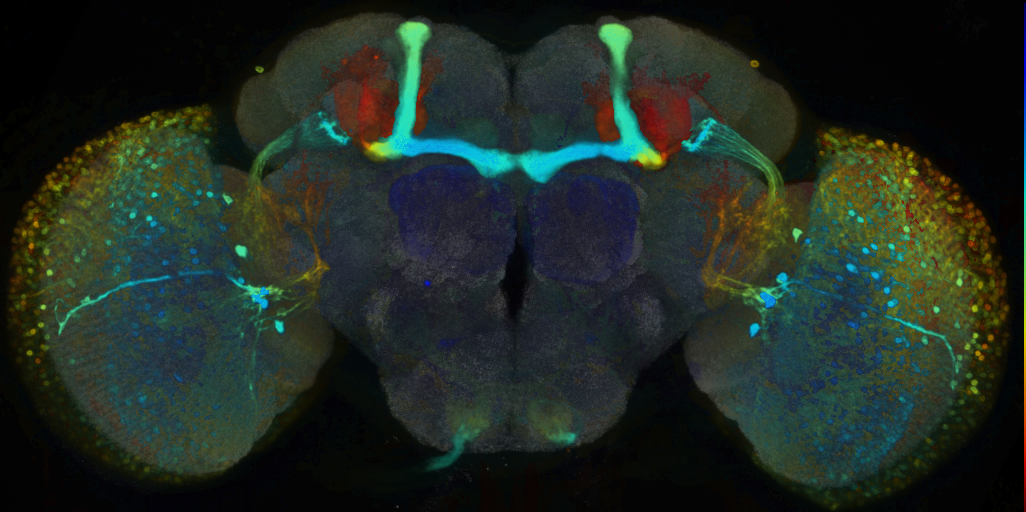 P{VT054844-GAL4} expression pattern