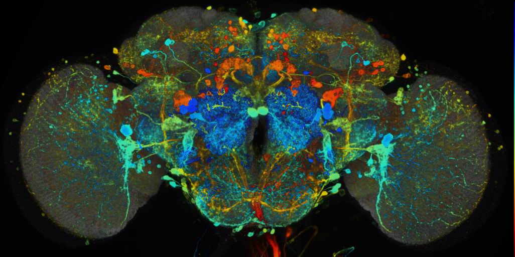 P{VT057241-GAL4} expression pattern