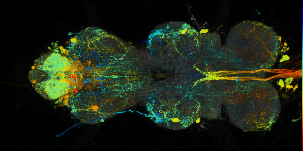P{VT057241-GAL4} expression pattern