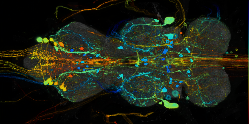 P{VT057247-GAL4} expression pattern