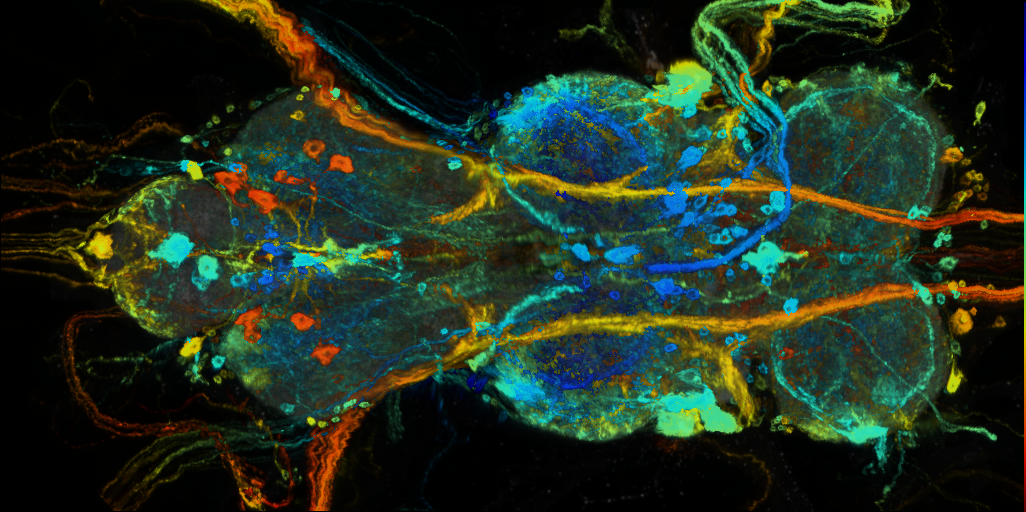 P{VT058722-GAL4} expression pattern