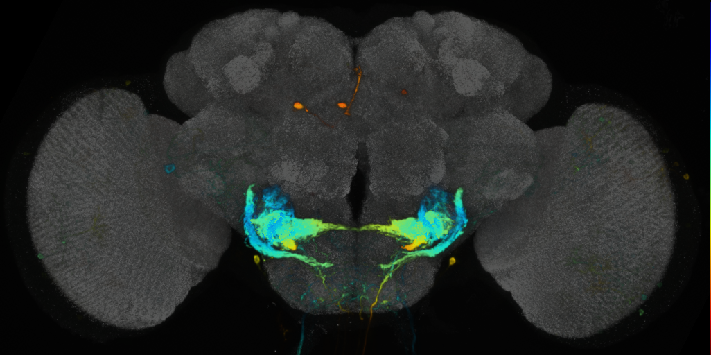 P{VT062870-GAL4} expression pattern