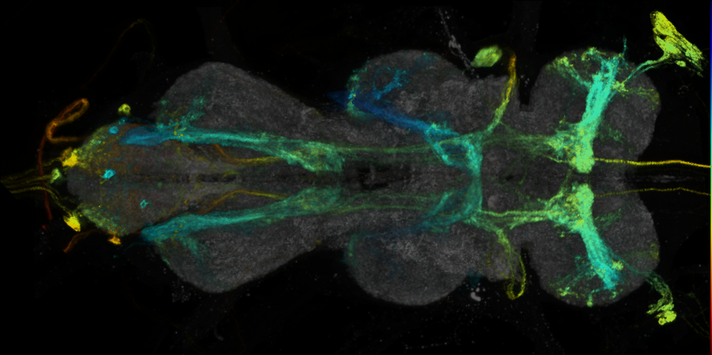 P{VT062870-GAL4} expression pattern