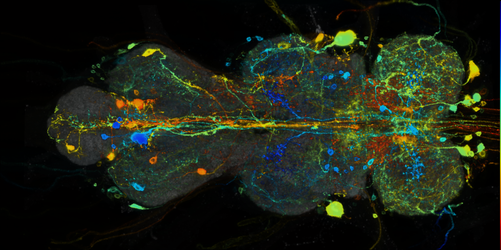 P{VT063626-GAL4} expression pattern