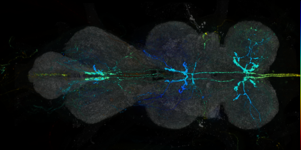 P{VT064508-GAL4} expression pattern
