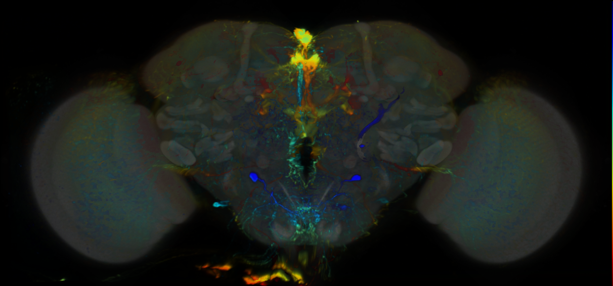 P{VT006398-GAL4} expression pattern