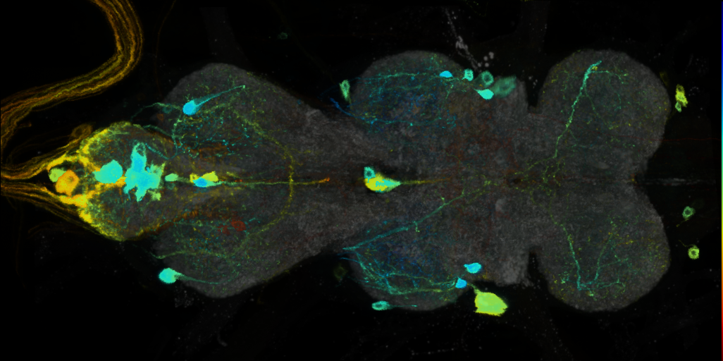 P{VT006398-GAL4} expression pattern