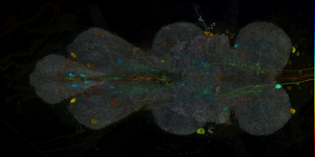 P{VT006868-GAL4} expression pattern