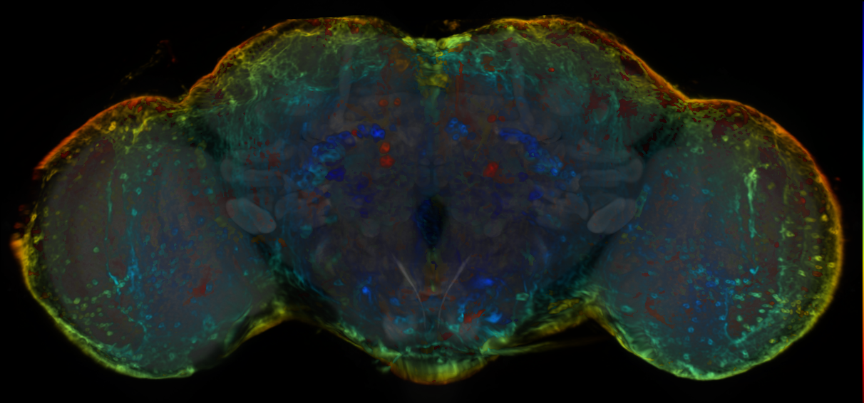 P{VT007397-GAL4} expression pattern