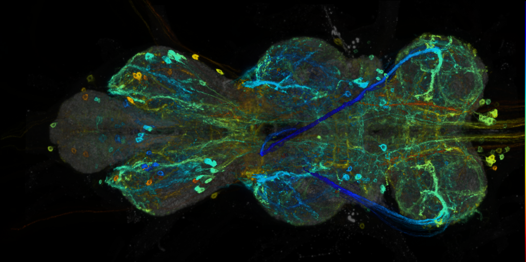 P{VT007753-GAL4} expression pattern
