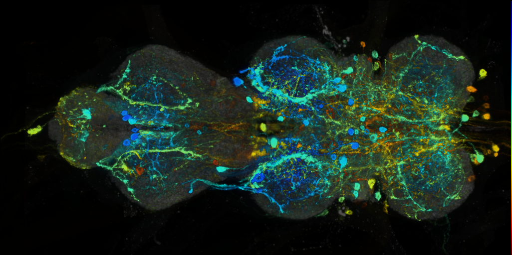 P{VT007764-GAL4} expression pattern