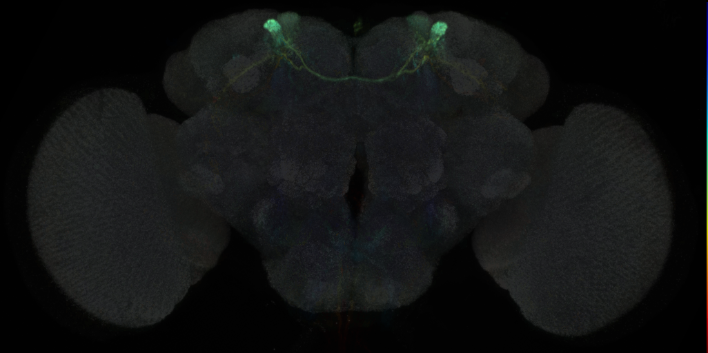JRC_MB308B in the Adult Brain