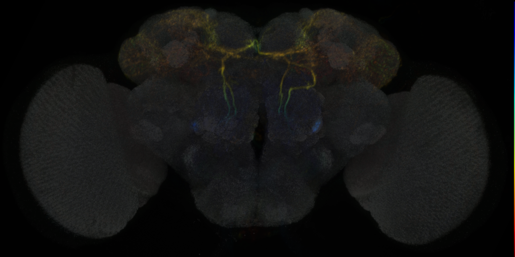 JRC_MB465C in the Adult Brain