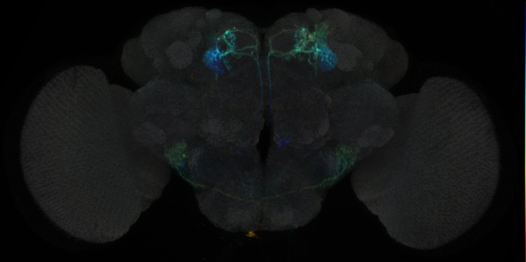 JRC_MB051C in the Adult Brain