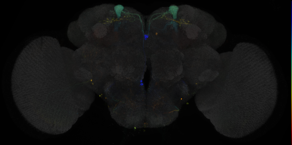 JRC_MB093C in the Adult Brain