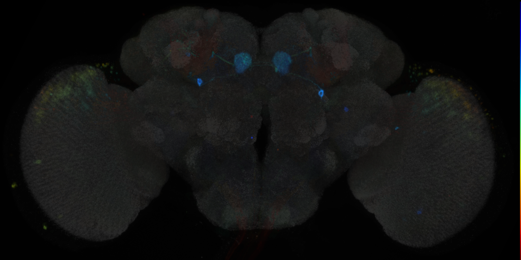 JRC_MB298B in the Adult Brain