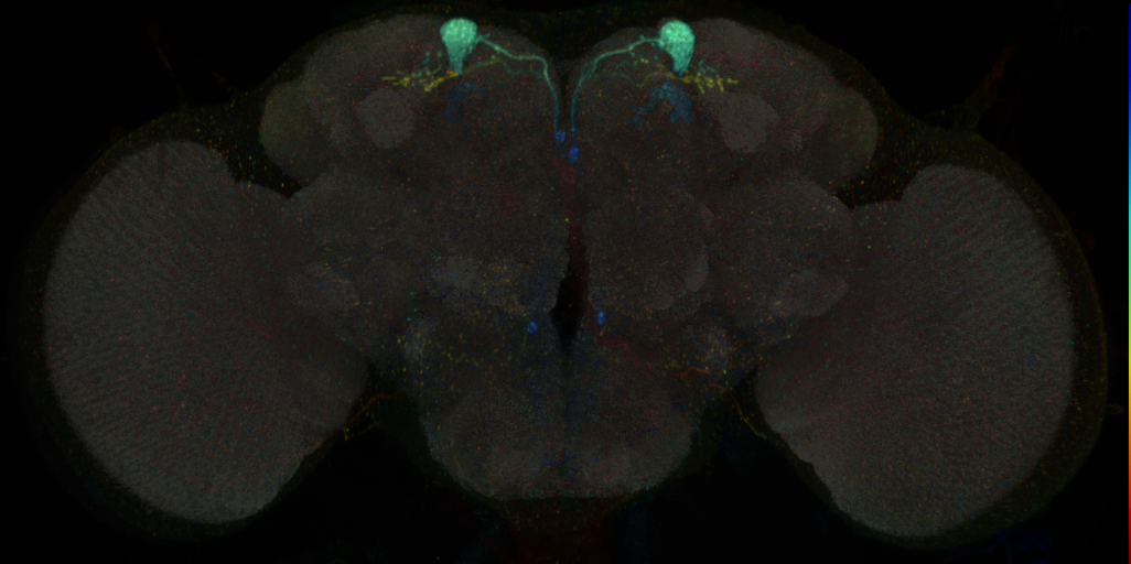 JRC_MB082C in the Adult Brain