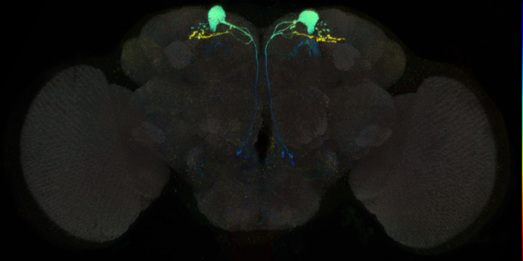 JRC_MB093C in the Adult Brain