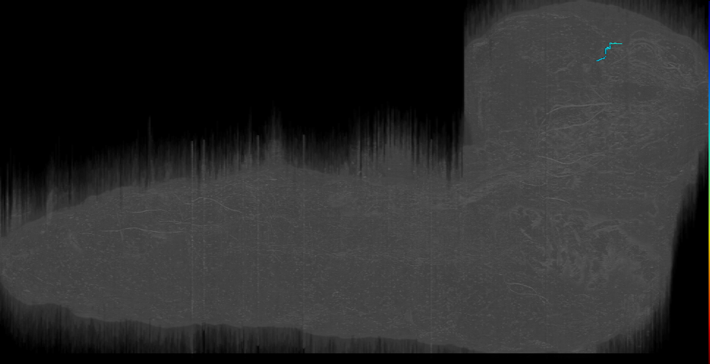 DPMpm1 s 3 Right (L1EM:13364562)