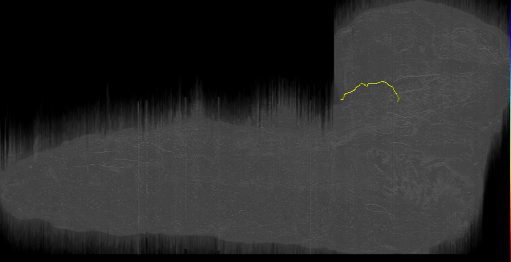 BLP34 a s 3 Left (L1EM:14504060)