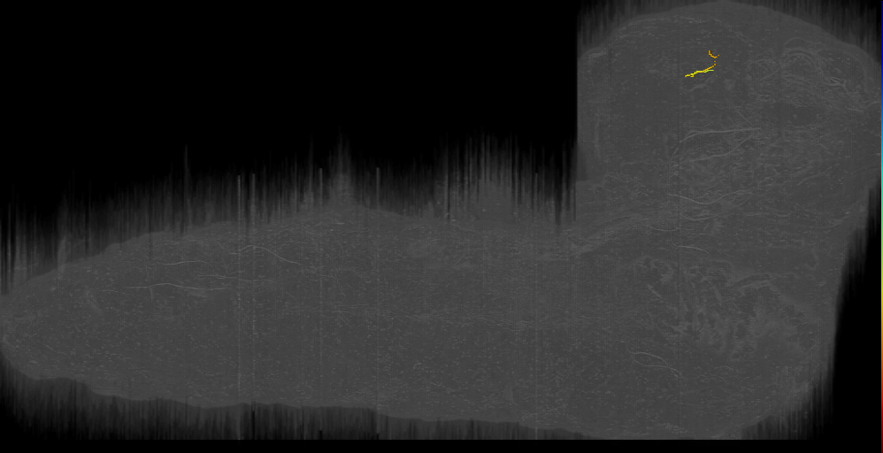 DPLc ant lat s 4 Left (L1EM:14973317)