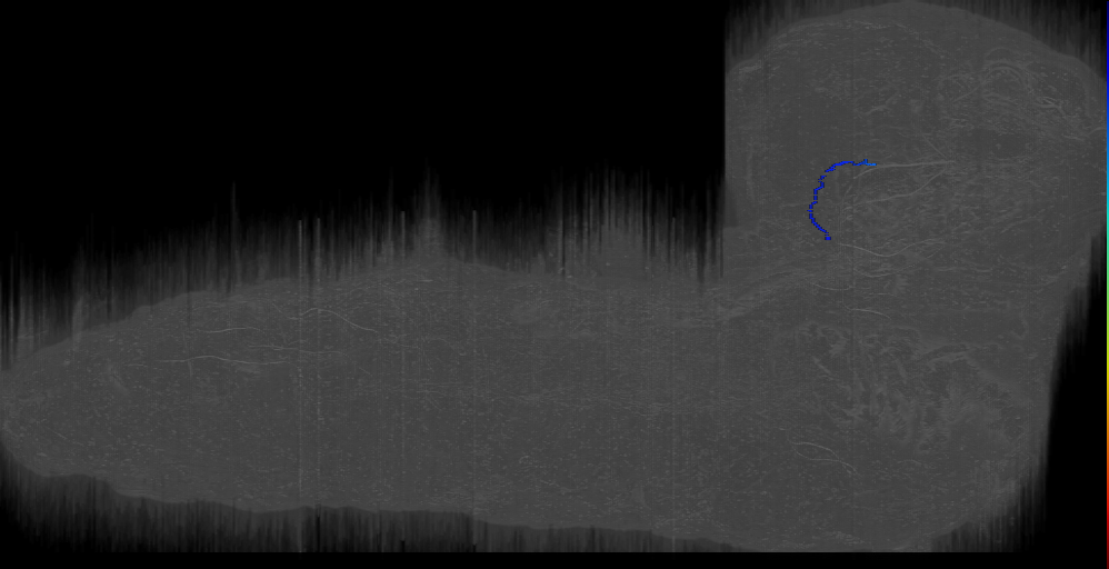 BLVa t s 2 Right (L1EM:17390827)