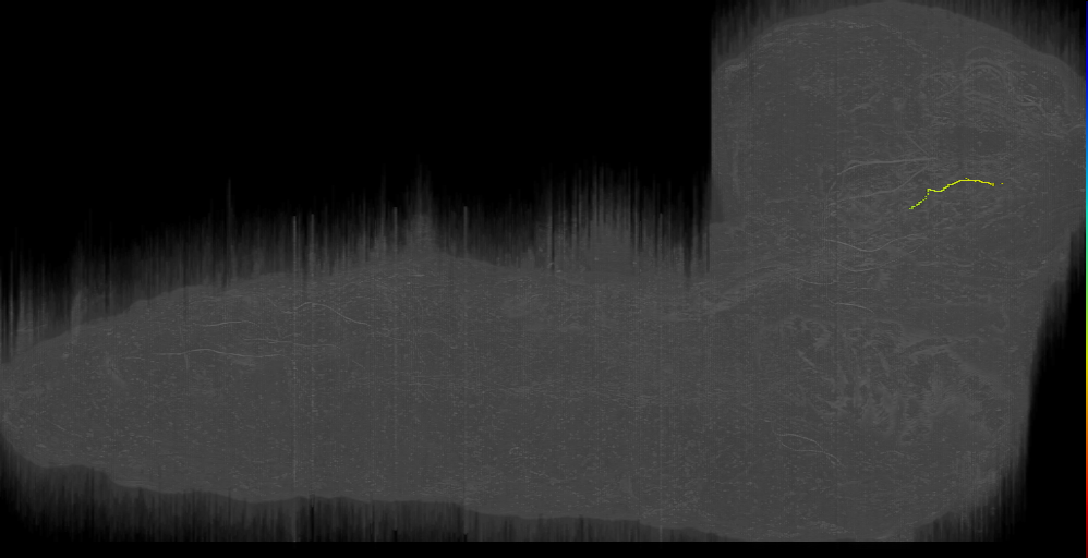 BAmd1 v s 1 Left (L1EM:17472365)