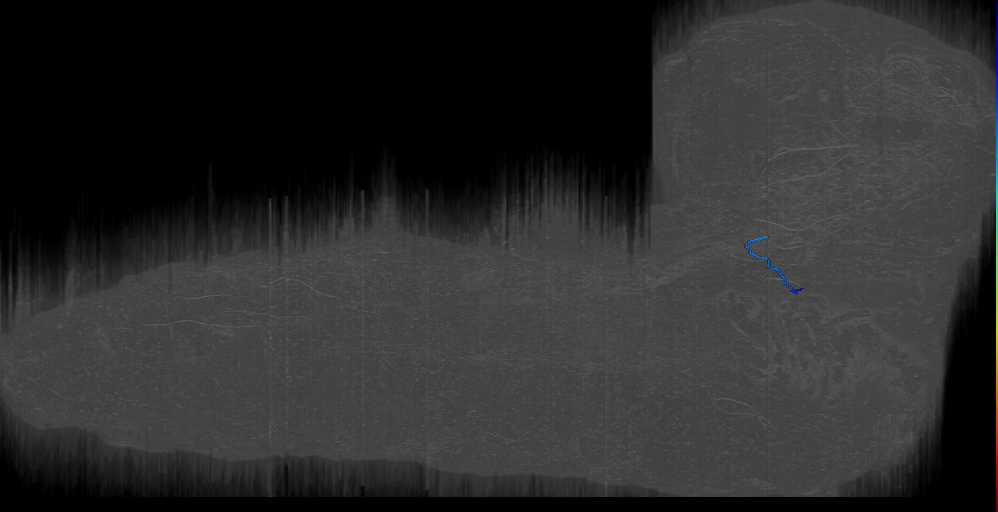 BAlv s 1 Right (L1EM:17634397)