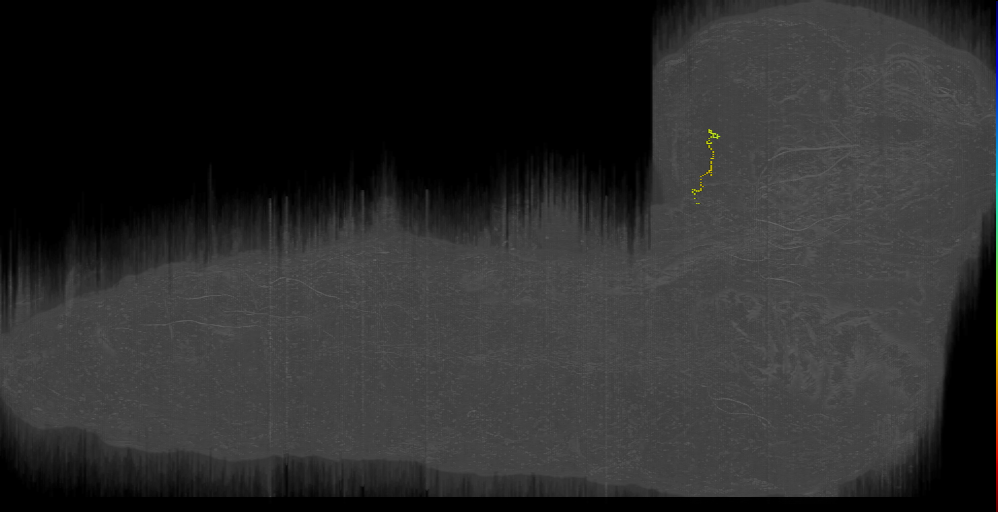 BLVa12 a s 2 Left (L1EM:17729394)