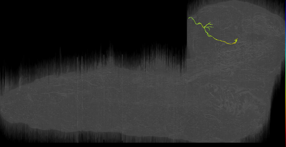 KC (L1EM:15691122)