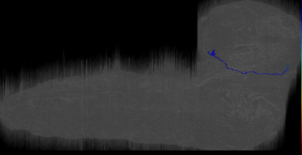 Rh6PR-5;right (L1EM:2544902)