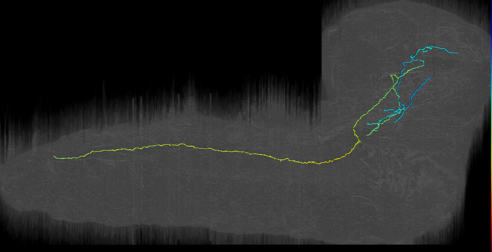 DPMm1 Brain descending into VNC right (L1EM:3595837)