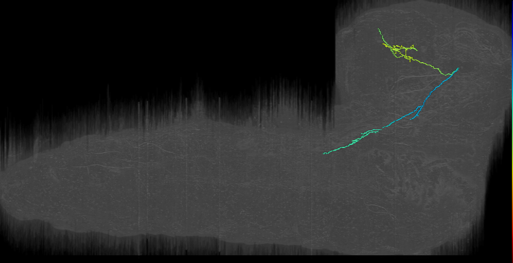 DPMpl12 Brain into SEZ left (L1EM:7338309)