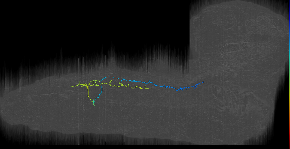 Contralateral axon (L1EM:18461988)