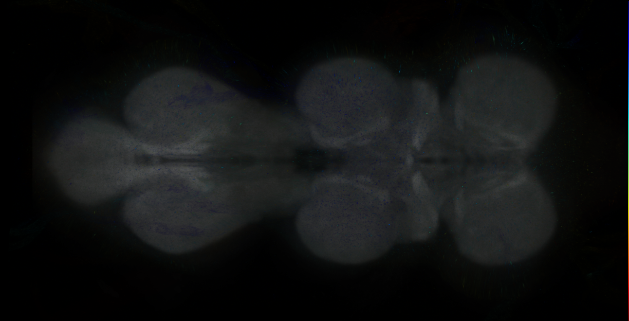 P{GMR10A01-GAL4} expression pattern