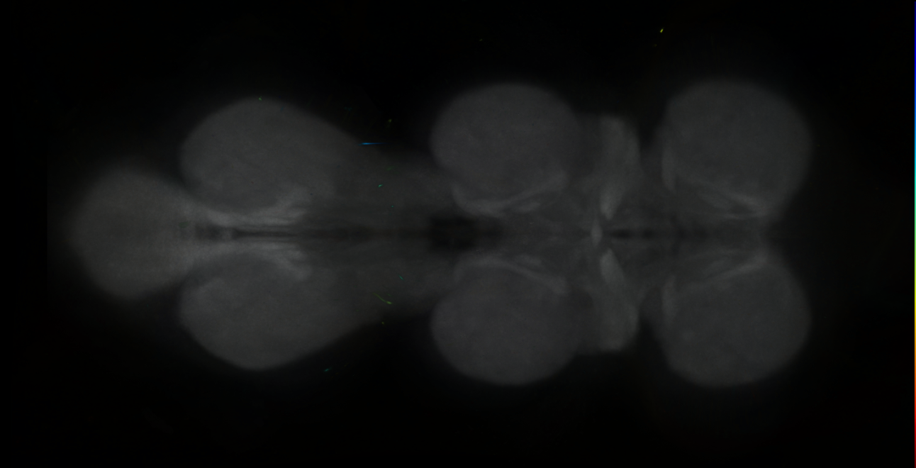 P{GMR10A02-GAL4} expression pattern