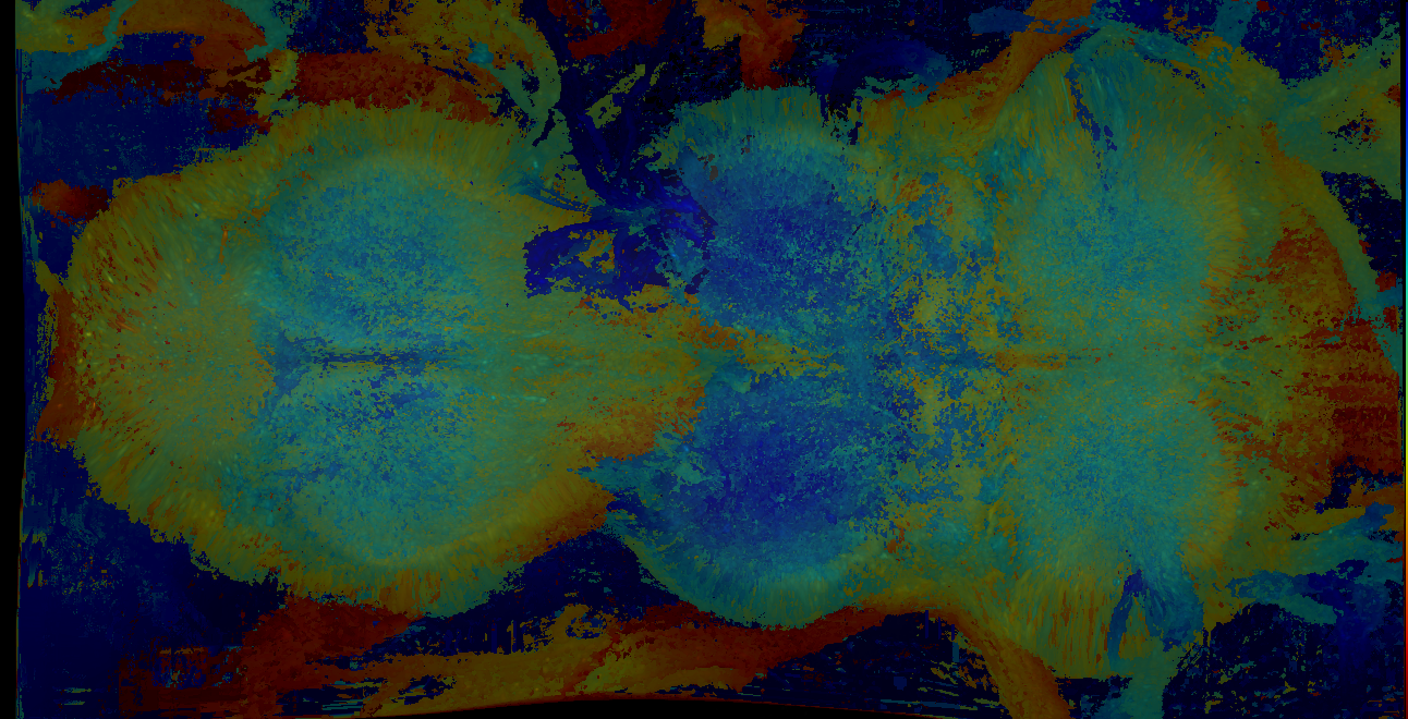 P{GMR10B08-GAL4} expression pattern