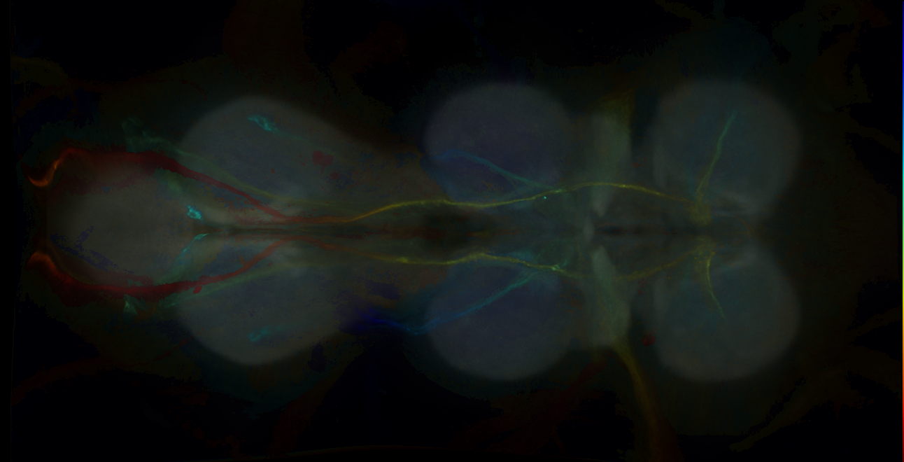 P{GMR10C04-GAL4} expression pattern