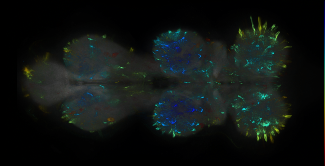 P{GMR10D07-GAL4} expression pattern
