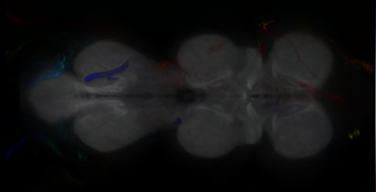 P{GMR10D08-GAL4} expression pattern