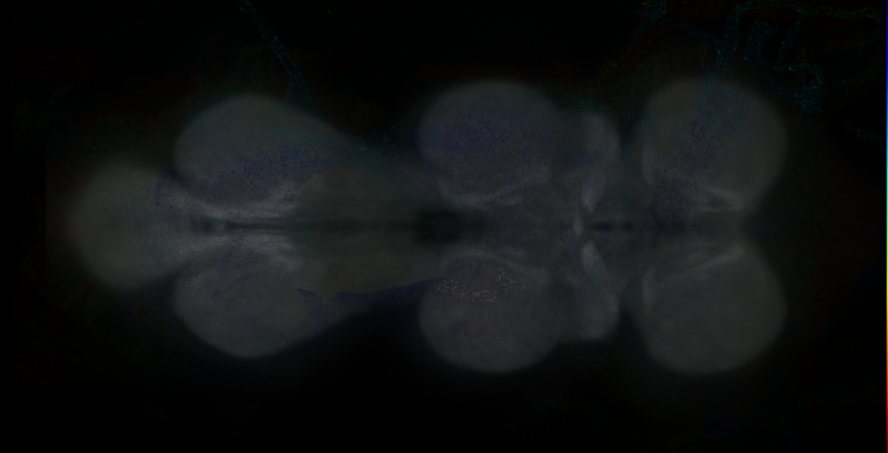 P{GMR10H07-GAL4} expression pattern