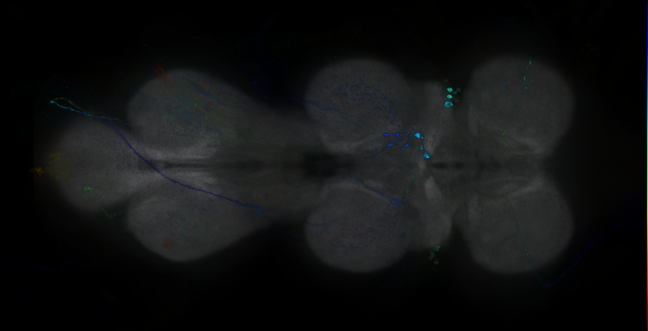 P{GMR11A01-GAL4} expression pattern