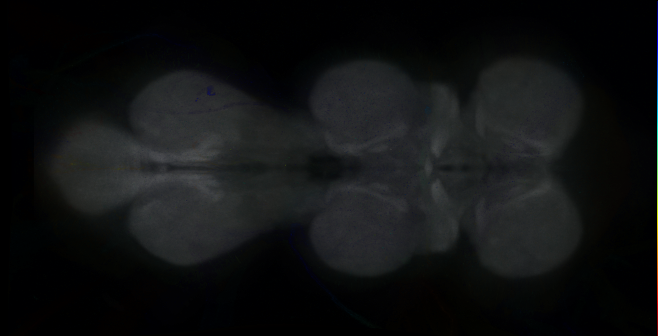 P{GMR11A06-GAL4} expression pattern