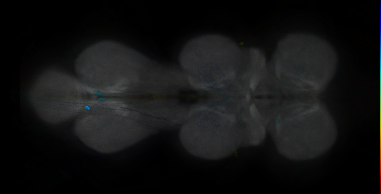 P{GMR11A10-GAL4} expression pattern