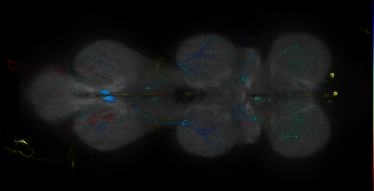P{GMR11A11-GAL4} expression pattern