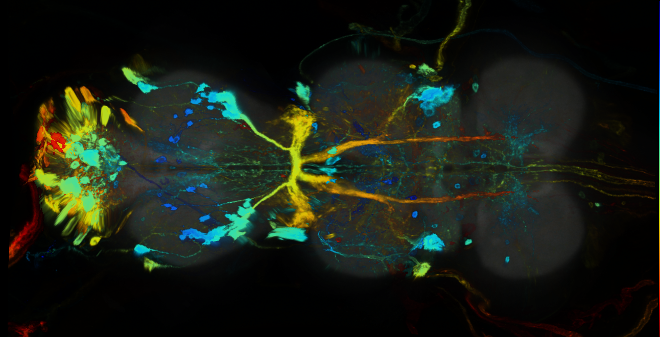 P{GMR11B06-GAL4} expression pattern