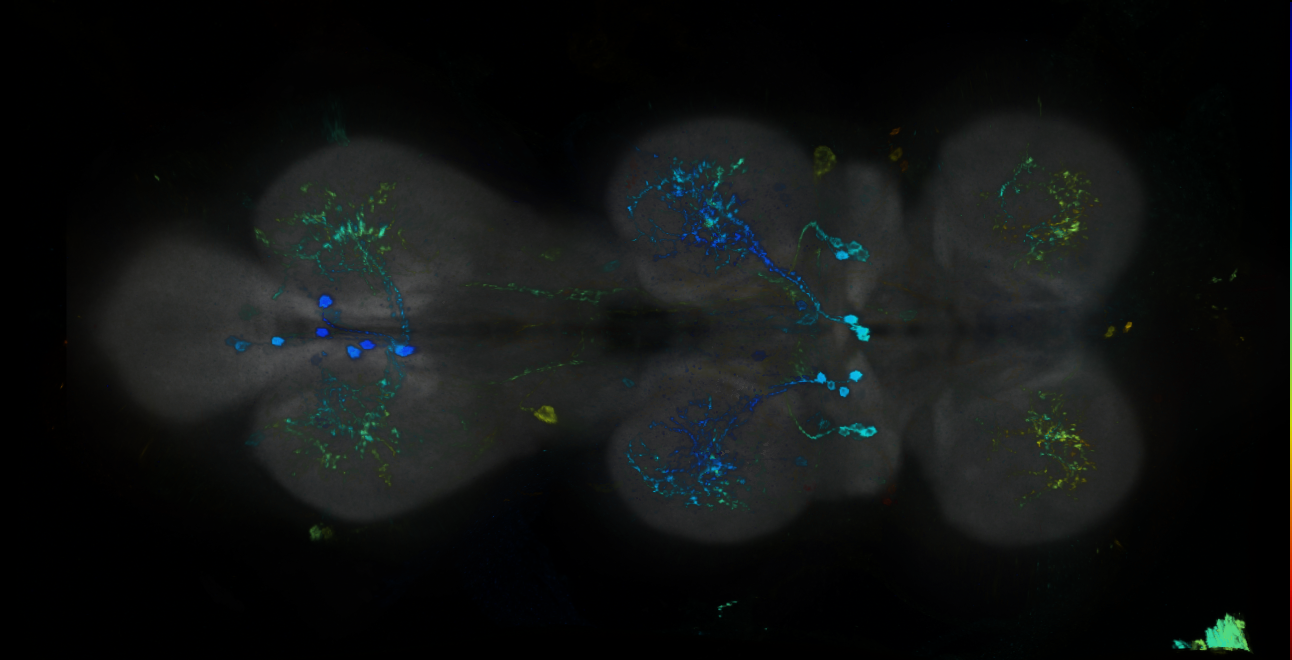 P{GMR11B07-GAL4} expression pattern
